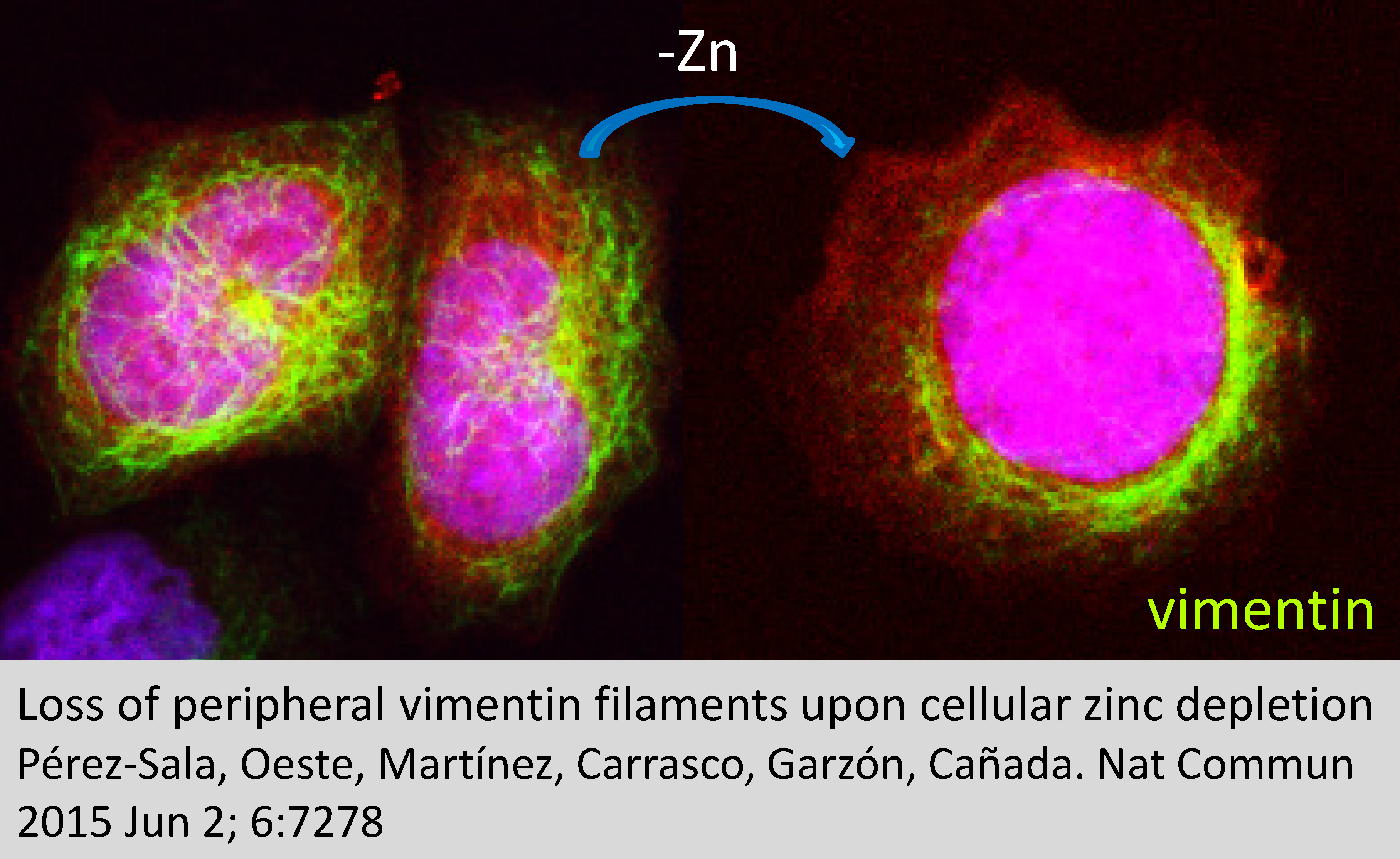 Vimentin: an intracellular armor?