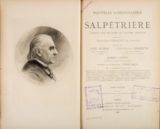 Nouvelle Iconographie de la Salpêtrière: clinique des maladies du système nerveux. Jean-Martin Charcot