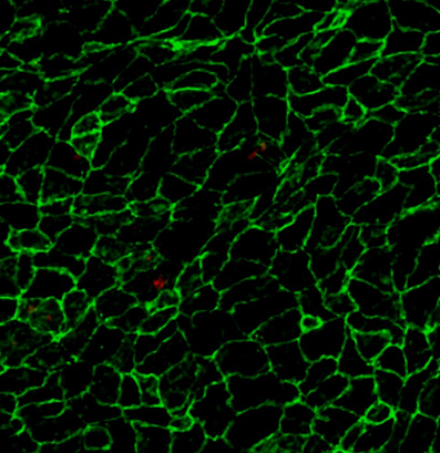 Discovered the mechanism to boost the intravascular crawling by a subset of circulating leukocytes