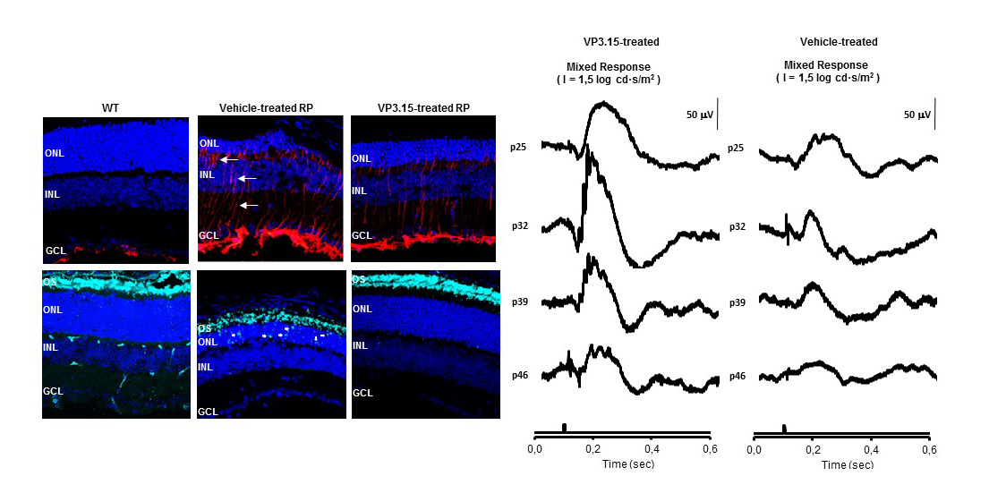 GSK-3 role as a potential therapeutic target for treatment of retinitis pigmentosa