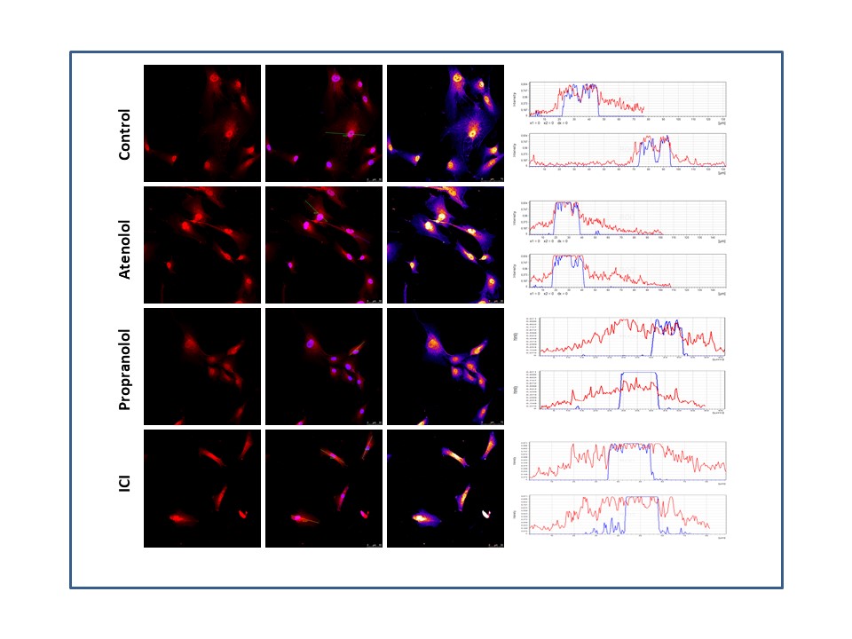 Identified a promising drug for von Hippel Lindau disease treatment