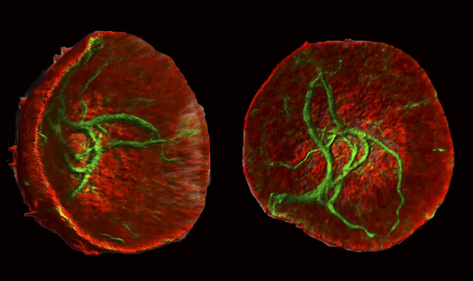 Identified a vimentin-actin interplay in mitosis