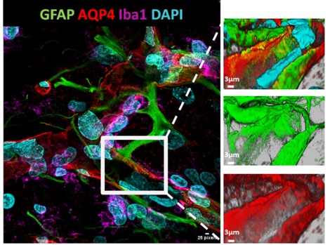 Imagen obtenida por microscopía confocal ilustrando el mantenimiento de la barrera hematoencefálica tras un ictus isquémico en un cerebro de una rata tratada con metoprolol intravenoso pre-reperfusión.