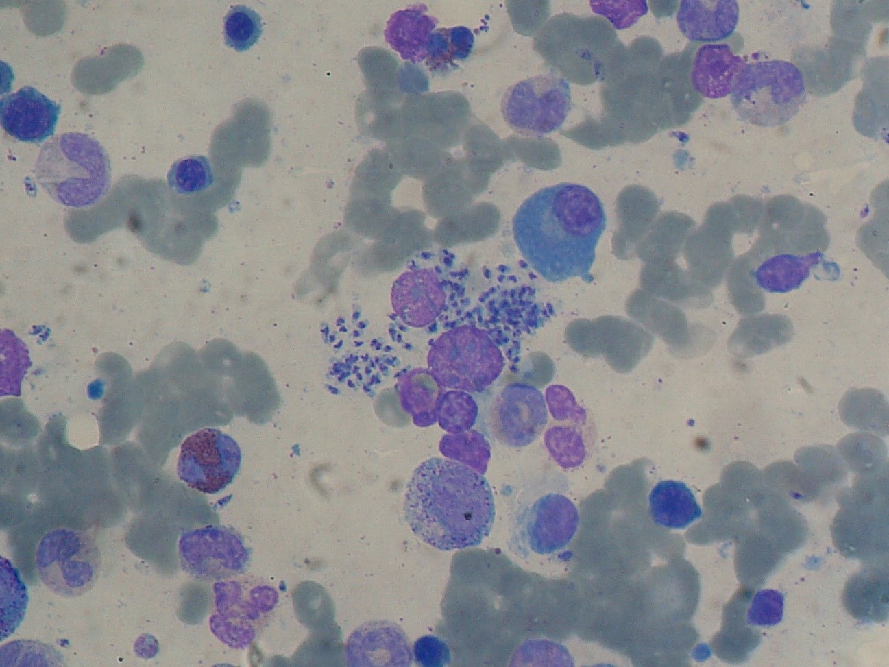 Bone marrow cells affected by visceral leishmaniasis. / Wikipedia