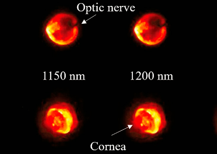 NIR images of two eyes where nanoparticles had been intravitreally injected. The images in the upper row correspond to an eye where the optical nerve can be inferred. The lower row corresponds to an eye where the cornea and lens are discernible. [Adapted from the paper]