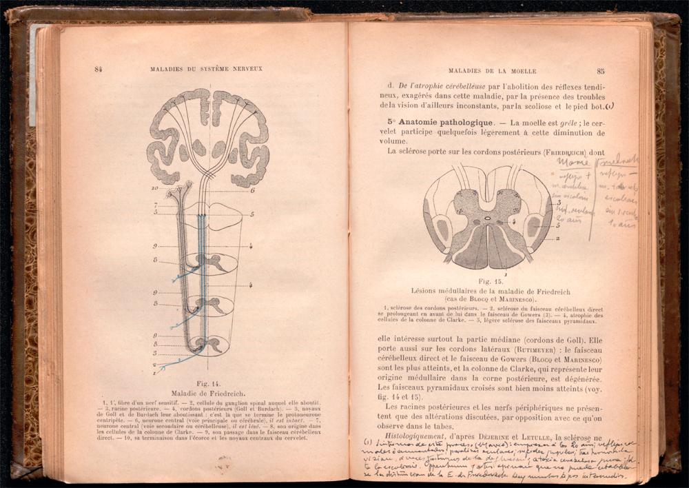 Imagen de una de las páginas manuscritas del libro Précis de pathologie interne de F.J. Collet