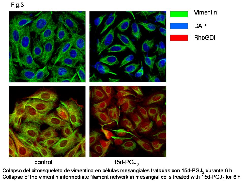Alteraciones del citoesqueleto por lipoxidación