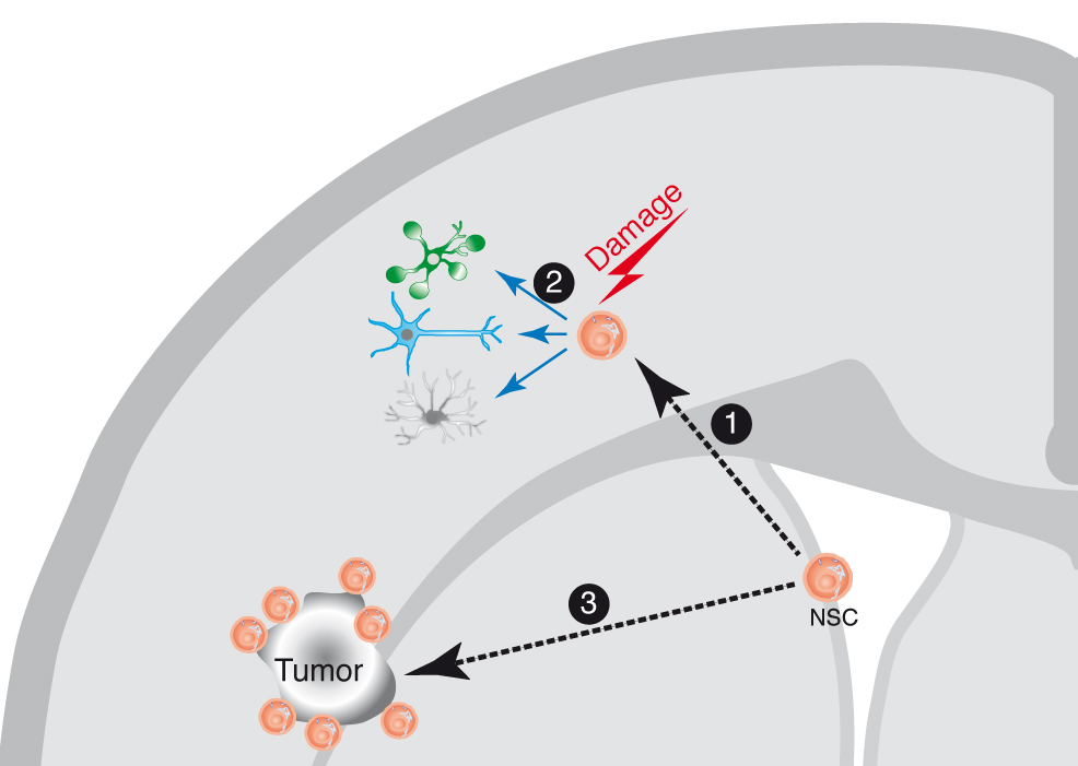 Neural Stem Cell response to brain damage